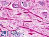 Anti-NPFFR2 antibody LS-A463 IHC of human brain, neurons and glia. Immunohistochemistry of formalin-fixed, paraffin-embedded tissue after heat-induced antigen retrieval.