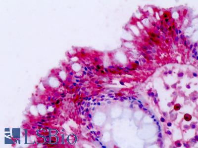Anti-NPFF2 / NPFFR2 antibody IHC of human colon. Immunohistochemistry of formalin-fixed, paraffin-embedded tissue after heat-induced antigen retrieval. Antibody LS-A3304 dilution 4-7 ug/ml.