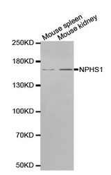 Western blot analysis of extracts of various cell lines, using NPHS1 antibody. (1: Mouse spleen tissue lysate 2: Mouse kidney tissue lysate).