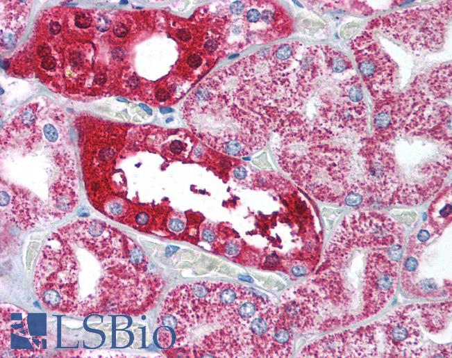 Anti-Nephrin antibody IHC of human kidney. Immunohistochemistry of formalin-fixed, paraffin-embedded tissue after heat-induced antigen retrieval. Antibody LS-B1382 concentration 5 ug/ml.