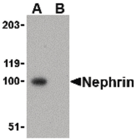 Western blot of Nephrin in mouse kidney tissue lysate with Nephrin antibody at 1 ug/ml in the (A) absence and (B) presence of blocking peptide.