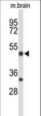 Western blot of MEF2A Antibody in mouse brain tissue lysates (35 ug/lane). MEF2A (arrow) was detected using the purified antibody.