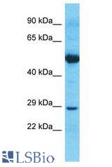 NPM2 antibody Western Blot of Thymus Tumor. Antibody dilution: 1 ug/ml.