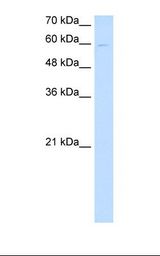 HepG2 cell lysate. Antibody concentration: 1.0 ug/ml. Gel concentration: 12%.