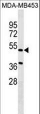 NPNT Antibody western blot of MDA-MB453 cell line lysates (35 ug/lane). The NPNT antibody detected the NPNT protein (arrow).