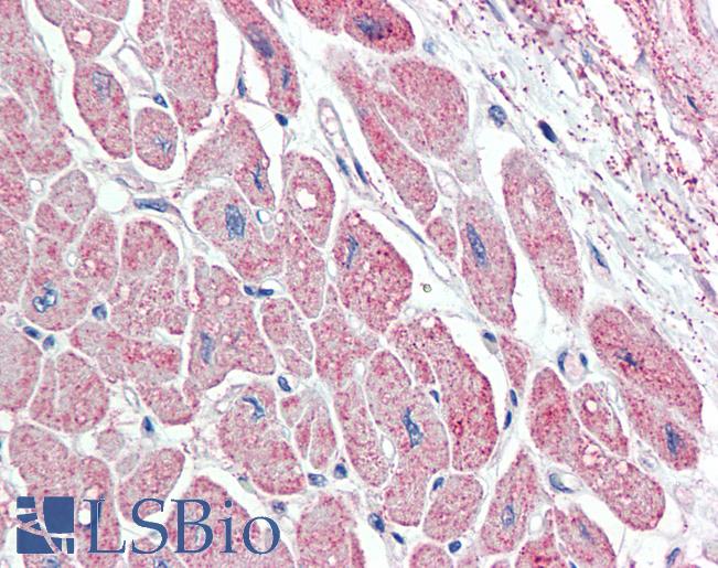 Anti-NPPA / ANP antibody IHC staining of human heart. Immunohistochemistry of formalin-fixed, paraffin-embedded tissue after heat-induced antigen retrieval. Antibody LS-B9548 concentration 5 ug/ml.