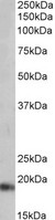 NPPA antibody (0.01 ug/ml) staining of Mouse Heart lysate (35 ug protein in RIPA buffer). Primary incubation was 1 hour. Detected by chemiluminescence.