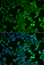 Immunofluorescence analysis of HeLa cell using NPRL2 antibody. Blue: DAPI for nuclear staining.