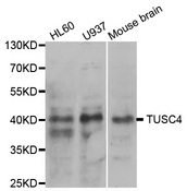 Western blot analysis of extracts of various cell lines, using NPRL2 antibody.