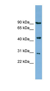NPRL2 / TUSC4 antibody LS-C107970 Western blot of NCI-H226 cell lysate.