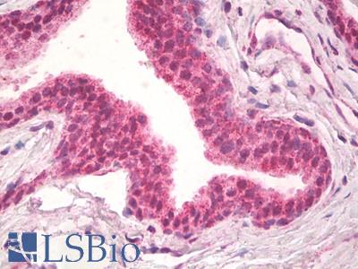 Anti-NPR3 antibody IHC staining of human prostate. Immunohistochemistry of formalin-fixed, paraffin-embedded tissue after heat-induced antigen retrieval.