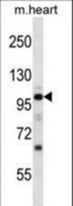 Mouse Npr1 Antibody western blot of mouse heart tissue lysates (35 ug/lane). The Npr1 antibody detected the Npr1 protein (arrow).