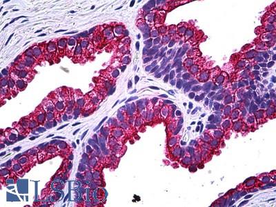 Anti-NPR2 antibody IHC of human prostate. Immunohistochemistry of formalin-fixed, paraffin-embedded tissue after heat-induced antigen retrieval. Antibody LS-B5482 concentration 5 ug/ml.
