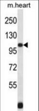 Mouse Npr2 Antibody western blot of mouse heart tissue lysates (35 ug/lane). The Npr2 antibody detected the Npr2 protein (arrow).