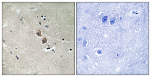 IHC of paraffin-embedded human brain tissue, using NPTN Antibody. The picture on the right is treated with the synthesized peptide.