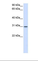 Fetal muscle lysate. Antibody concentration: 1.0 ug/ml. Gel concentration: 12%.