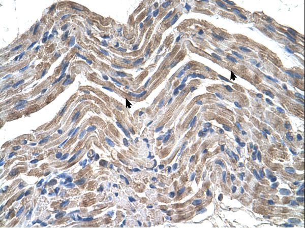 NPTN antibody LS-C80959 was used in IHC to stain formalin-fixed, paraffin-embedded human muscle.