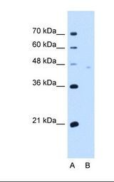 Lane A: Marker. Lane B: HepG2 cell lysate. Antibody concentration: 5.0 ug/ml. Gel concentration: 12%.