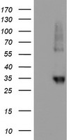 HEK293T cells were transfected with the pCMV6-ENTRY control (Left lane) or pCMV6-ENTRY NPTN (Right lane) cDNA for 48 hrs and lysed. Equivalent amounts of cell lysates (5 ug per lane) were separated by SDS-PAGE and immunoblotted with anti-NPTN.
