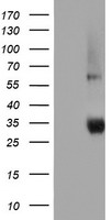 HEK293T cells were transfected with the pCMV6-ENTRY control (Left lane) or pCMV6-ENTRY NPTN (Right lane) cDNA for 48 hrs and lysed. Equivalent amounts of cell lysates (5 ug per lane) were separated by SDS-PAGE and immunoblotted with anti-NPTN.