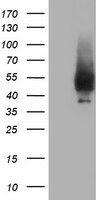 HEK293T cells were transfected with the pCMV6-ENTRY control (Left lane) or pCMV6-ENTRY NPTN (Right lane) cDNA for 48 hrs and lysed. Equivalent amounts of cell lysates (5 ug per lane) were separated by SDS-PAGE and immunoblotted with anti-NPTN.