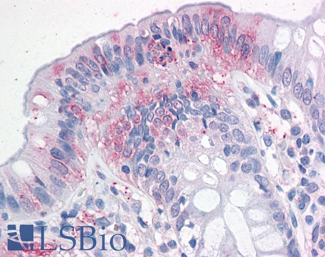Anti-NPTN antibody LS-A9023 IHC of human colon. Immunohistochemistry of formalin-fixed, paraffin-embedded tissue after heat-induced antigen retrieval.