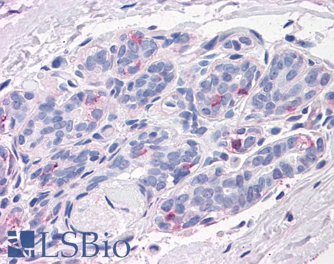Anti-NPTN antibody LS-A9023 IHC of human breast. Immunohistochemistry of formalin-fixed, paraffin-embedded tissue after heat-induced antigen retrieval.