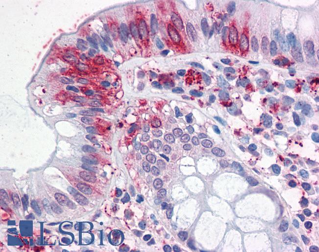 Anti-NPTN antibody LS-A9022 IHC of human colon. Immunohistochemistry of formalin-fixed, paraffin-embedded tissue after heat-induced antigen retrieval.