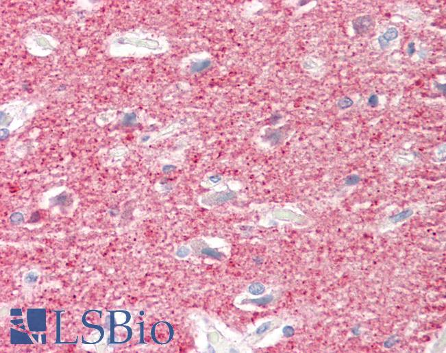Anti-MEF2B antibody IHC staining of human brain, cortex. Immunohistochemistry of formalin-fixed, paraffin-embedded tissue after heat-induced antigen retrieval. Antibody LS-B9933 concentration 10 ug/ml.