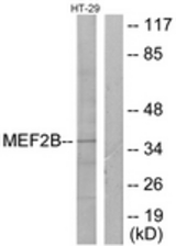 Western blot of extracts from HT-29 cells, using MEF2B Antibody. The lane on the right is treated with the synthesized peptide.