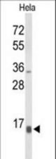 Western blot of NPW Antibody in HeLa cell line lysates (35 ug/lane). NPW (arrow) was detected using the purified antibody.