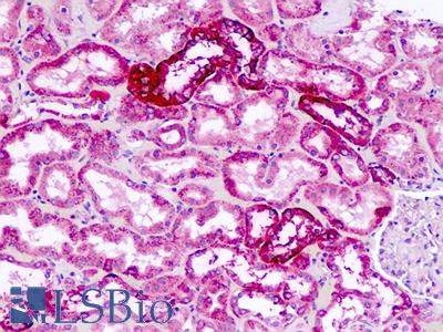 Human, Kidney: Formalin-Fixed Paraffin-Embedded (FFPE)