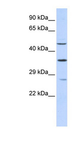 MEF2B antibody LS-C110308 Western blot of 293T cell lysate.