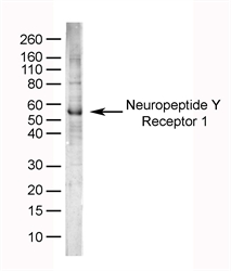 Human brain lysate probed with Sheep anti-Human Neuropeptide Y Receptor 1 (LS-C27287).