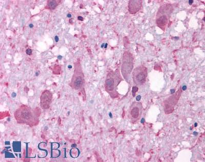 Anti-NPY2R antibody LS-A1061 IHC of human brain, neurons and glia. Immunohistochemistry of formalin-fixed, paraffin-embedded tissue after heat-induced antigen retrieval.