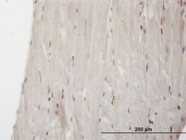 Immunoperoxidase of monoclonal antibody to MEF2B on formalin-fixed paraffin-embedded human skeletal muscle. [antibody concentration 3 ug/ml]