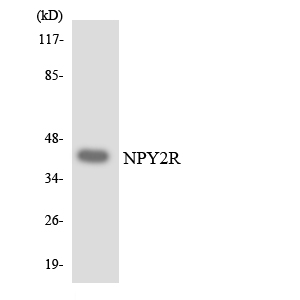 Western blot of the lysates from HUVEC cells using NPY2R antibody.