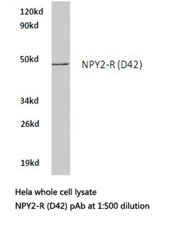 Western blot of NPY2-R (D42) pAb in extracts from HeLa cells.