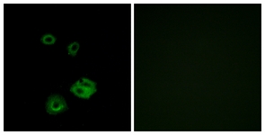 Immunofluorescence of A549 cells, using NPY2R Antibody. The picture on the right is treated with the synthesized peptide.