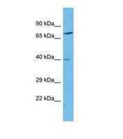 Western blot of Human Esophagus Tumor. NPY2R antibody dilution 1.0 ug/ml.