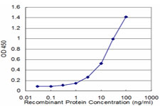 Detection limit for recombinant GST tagged MEF2B is approximately 1 ng/ml as a capture antibody.