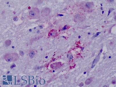 Anti-PPYR1 antibody IHC of human brain, hypothalamus. Immunohistochemistry of formalin-fixed, paraffin-embedded tissue after heat-induced antigen retrieval. Antibody LS-A1070 dilution 16 ug/ml.