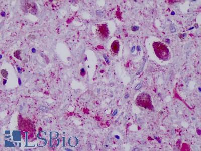Anti-PPYR1 antibody IHC of human brain, substantia nigra. Immunohistochemistry of formalin-fixed, paraffin-embedded tissue after heat-induced antigen retrieval. Antibody LS-A1070 dilution 16 ug/ml.