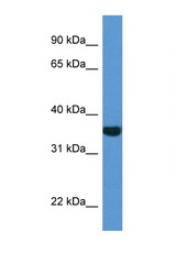 NQO1 antibody LS-C135934 Western blot of 721_B Cell lysate. Antibody concentration 1 ug/ml.