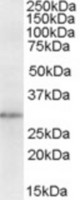 Antibody staining (1 ug/ml) of Human Lung lysate (RIPA buffer, 35 ug total protein per lane). Primary incubated for 1 hour. Detected by Western blot of chemiluminescence.