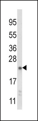 Western blot of NQO2 Antibody in mouse liver tissue lysates (35 ug/lane). NQO2 (arrow) was detected using the purified antibody.