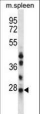 NQO2 Antibody western blot of mouse spleen tissue lysates (35 ug/lane). The NQO2 antibody detected the NQO2 protein (arrow).