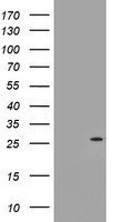 HEK293T cells were transfected with the pCMV6-ENTRY control (Left lane) or pCMV6-ENTRY NQO2 (Right lane) cDNA for 48 hrs and lysed. Equivalent amounts of cell lysates (5 ug per lane) were separated by SDS-PAGE and immunoblotted with anti-NQO2.