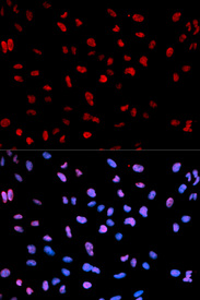 Immunofluorescence analysis of U2OS cell using Phospho-MEF2C-S396 antibody. Blue: DAPI for nuclear staining.