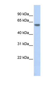 THRB antibody LS-C110233 Western blot of Fetal Brain lysate.